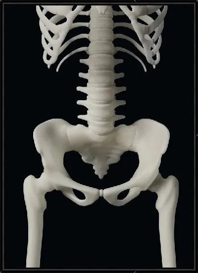 Картина Тазобедренный сустав