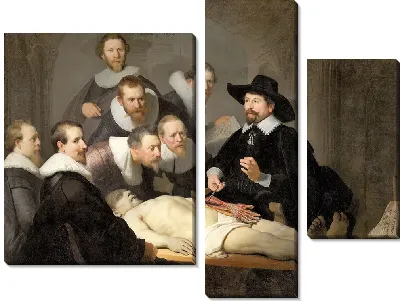 Картина Урок анатомии доктора Тульпа