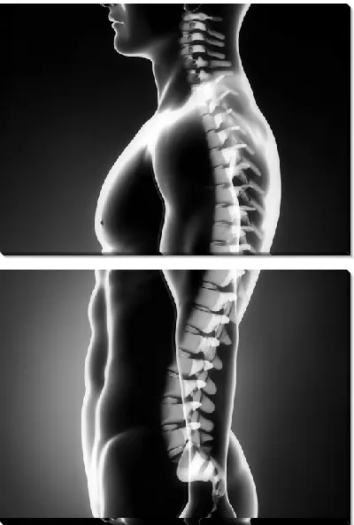 Модульная картина Позвоночник (Spine)