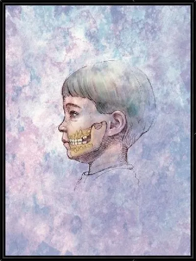 Картина Челюсть (Челюсть)