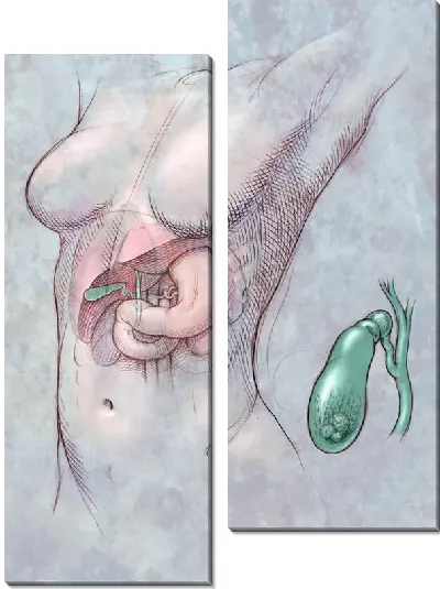 Модульная картина Желчный пузырь (Gallbladder)