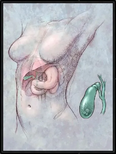 Картина Желчный пузырь (Gallbladder)
