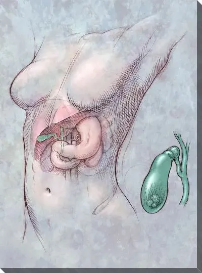 Постер Желчный пузырь (Gallbladder)
