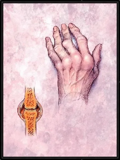 Картина Строение руки (The structure of the hand) №2