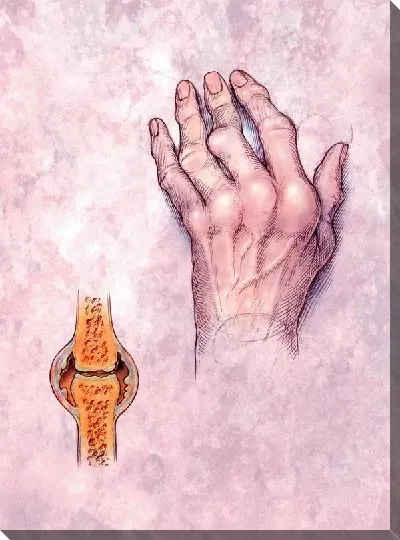 Постер Строение руки (The structure of the hand) №2