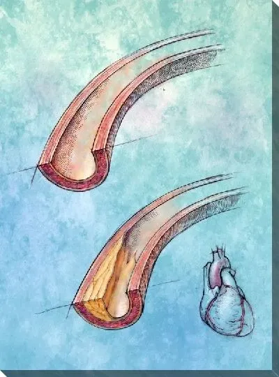 Постер Артерии (Arteries)