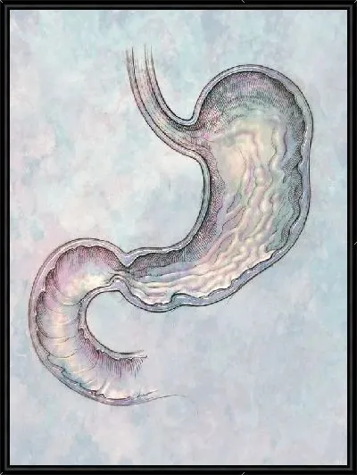 Картина Желудок (Stomach)