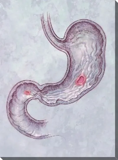 Постер Желудок (Stomach) №2