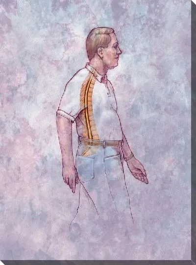 Постер Позвоночник (Spine) №3